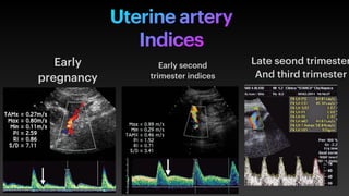 Presentation 3 uterine artery doppler .pdf