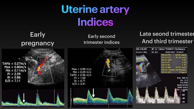 Presentation 3 uterine artery doppler .pdf | Pregnancy | Reproductive ...