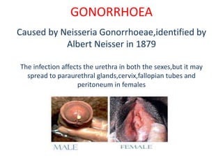 GONORRHOEA
Caused by Neisseria Gonorrhoeae,identified by
Albert Neisser in 1879
The infection affects the urethra in both the sexes,but it may
spread to paraurethral glands,cervix,fallopian tubes and
peritoneum in females
 