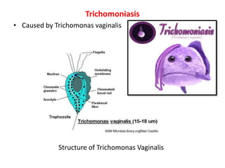 Trichomoniasis
• Caused by Trichomonas vaginalis
Structure of Trichomonas Vaginalis
 