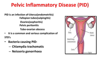 Pelvic Inflammatory Disease (PID)
PID is an infection of-Uterus(endometritis)
Fallopian tubes(salpingitis)
Ovaries(oophoritis)
Pelvis peritonitis
Tubo-ovarian abscess
• It is a common and serious complication of
STD’s
• Bacteria causing PID-
– Chlamydia trachomatis
– Neisseria gonorrhoea
 
