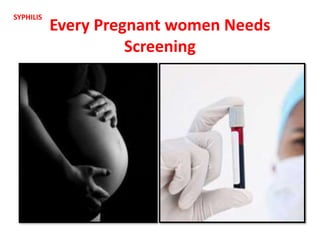 Every Pregnant women Needs
Screening
SYPHILIS
 