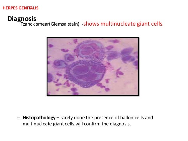 Herpes genitalis partnersuche