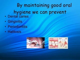 Oral Hygiene