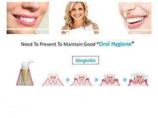 Oral Hygiene