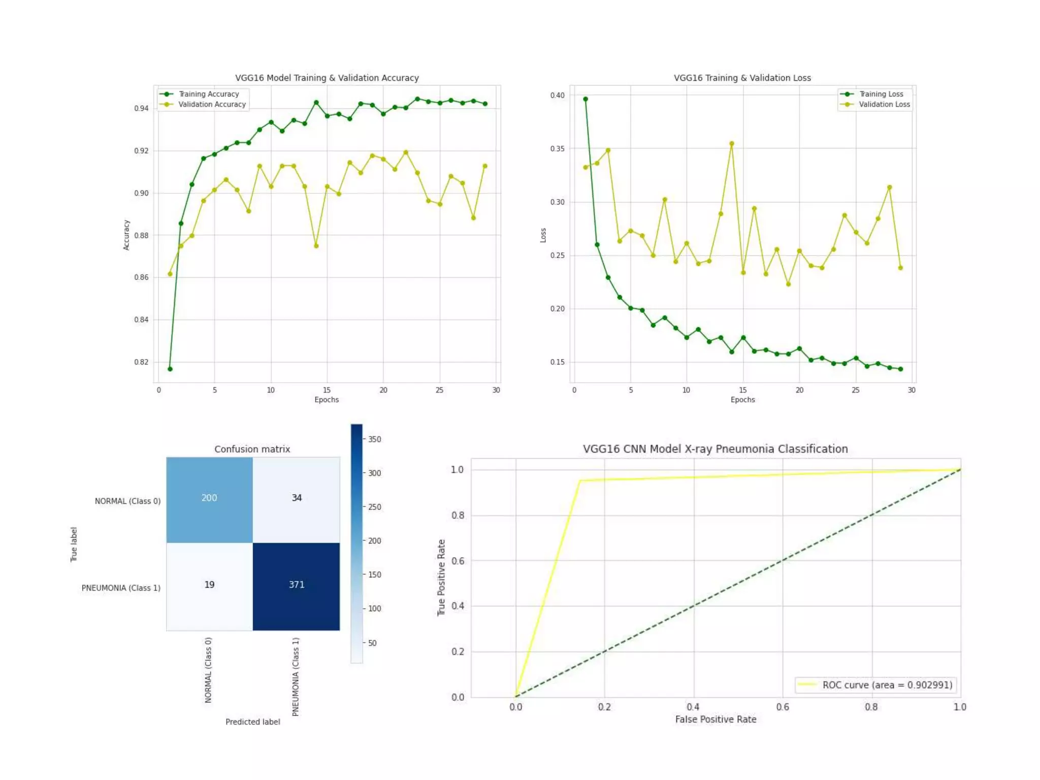 Chest X-ray Pneumonia Classification with Deep Learning