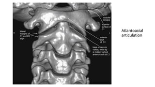 Atlantoaxial
articulation
 