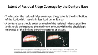 Comprehensive Support and Retention Strategies for Distal Extension ...