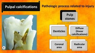 GERIATRIC ENDODONTICS , DR. ANUBHUTI BDS,MDS | PPTX