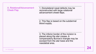 A. Rotational/Advancement
Cheek Flap
1 1 / 1 5 / 2 0 2 2
24
1. Dorsolateral nasal defects may be
reconstructed with large rotational
advancement cheek flaps.
2. This flap is based on the subdermal
blood supply.
3. The inferior border of the incision is
placed along the alar crease. A
compensatory Burrow’s triangle may be
excised from the alar base and the
nasolabial area.
 