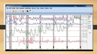 Polygraph Instrument | PPTX