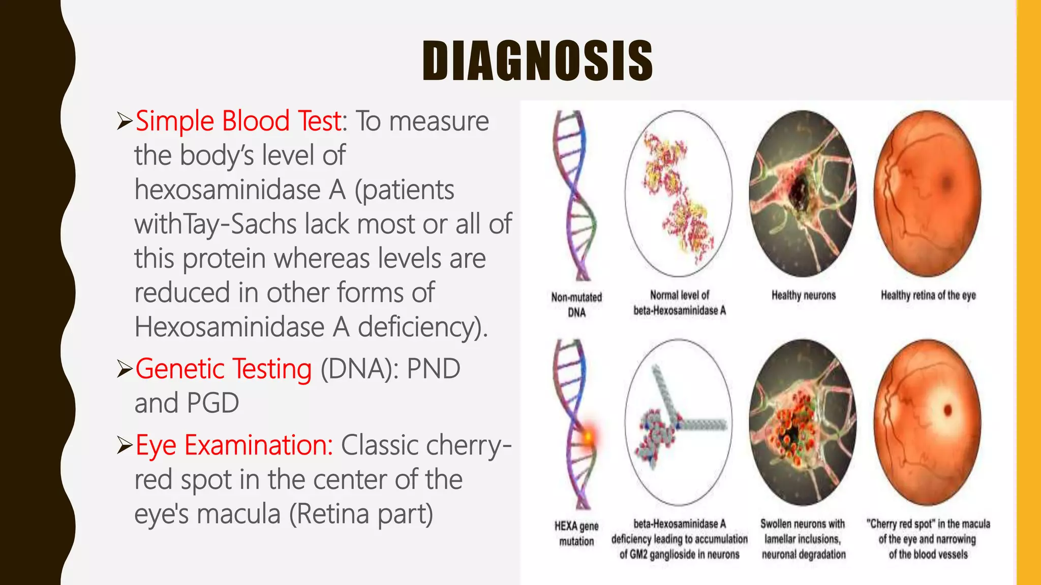 DIAGNOSIS
Simple Blood Test: To measure
the body’s level of
hexosaminidase A (patients
withTay-Sachs lack most or all of
this protein whereas levels are
reduced in other forms of
Hexosaminidase A deficiency).
Genetic Testing (DNA): PND
and PGD
Eye Examination: Classic cherry-
red spot in the center of the
eye's macula (Retina part)
 