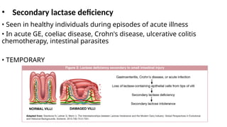• Secondary lactase deficiency
• Seen in healthy individuals during episodes of acute illness
• In acute GE, coeliac disease, Crohn's disease, ulcerative colitis
chemotherapy, intestinal parasites
• TEMPORARY
 