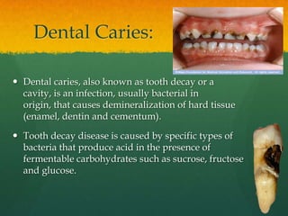Dental Caries:

 Dental caries, also known as tooth decay or a
  cavity, is an infection, usually bacterial in
  origin, that causes demineralization of hard tissue
  (enamel, dentin and cementum).

 Tooth decay disease is caused by specific types of
  bacteria that produce acid in the presence of
  fermentable carbohydrates such as sucrose, fructose
  and glucose.
 