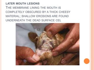 LATER MOUTH LESIONS
THE MEMBRANE LINING THE MOUTH IS
COMPLETELY OBSCURED BY A THICK CHEESY
MATERIAL; SHALLOW EROSIONS ARE FOUND
UNDERNEATH THE DEAD SURFACE CEL
 
