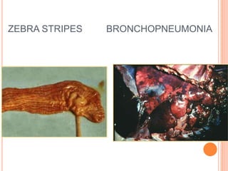 ZEBRA STRIPES BRONCHOPNEUMONIA
 