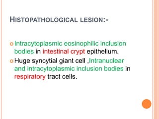 HISTOPATHOLOGICAL LESION:-
Intracytoplasmic eosinophilic inclusion
bodies in intestinal crypt epithelium.
Huge syncytial giant cell ,Intranuclear
and intracytoplasmic inclusion bodies in
respiratory tract cells.
 