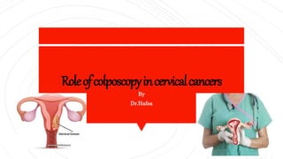 Roleofcolposcopyincervicalcancers
By
Dr.Hafsa
 