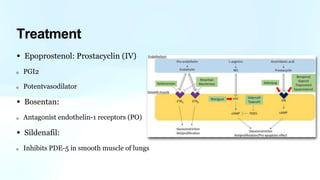 • Epoprostenol: Prostacyclin (IV)
PGI2
Potentvasodilator
• Bosentan:
Antagonist endothelin-1 receptors (PO)
• Sildenafil:
Inhibits PDE-5 in smooth muscle of lungs
Treatment
 