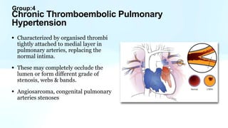 Group:4
• Characterized by organised thrombi
tightly attached to medial layer in
pulmonary arteries, replacing the
normal intima.
• These may completely occlude the
lumen or form different grade of
stenosis, webs & bands.
• Angiosarcoma, congenital pulmonary
arteries stenoses
Chronic Thromboembolic Pulmonary
Hypertension
 