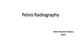 Pelvis Radiography
Mohd Abdullah Siddiqui
MMIT
 