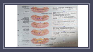 Atherosclerosis and ischemic heart disease | PPTX