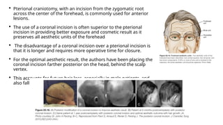 Circumcoronal Incision Presentation on incisions and closures . | PPTX