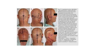 Presentation on incisions and closures . | PPTX