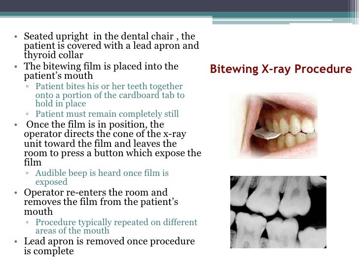 Presentation8 colonsocopy, bitewing xray, hernioplasty, anastomosis