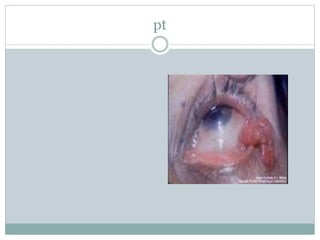 pt
 