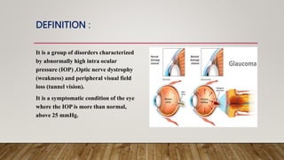 DEFINITION :
It is a group of disorders characterized
by abnormally high intra ocular
pressure (IOP) ,Optic nerve dystrophy
(weakness) and peripheral visual field
loss (tunnel vision).
It is a symptomatic condition of the eye
where the IOP is more than normal,
above 25 mmHg.
 