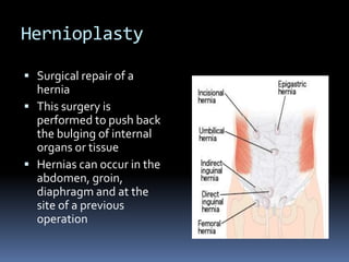HernioplastySurgical repair of a herniaThis surgery is performed to push back the bulging of internal organs or tissue Hernias can occur in the abdomen, groin, diaphragmand at the site of a previous operation