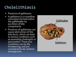 CholelithiasisPresence of gallstonesA gallstone is a crystalline concretion formed within the gallbladder by accretion of bile componentsPresence of gallstones can cause obstruction of the bile ducts, which can lead to serious conditions such as ascending cholangitis or pancreatitis. These two conditions can be life-threatening, and are considered to be medical emergencies.