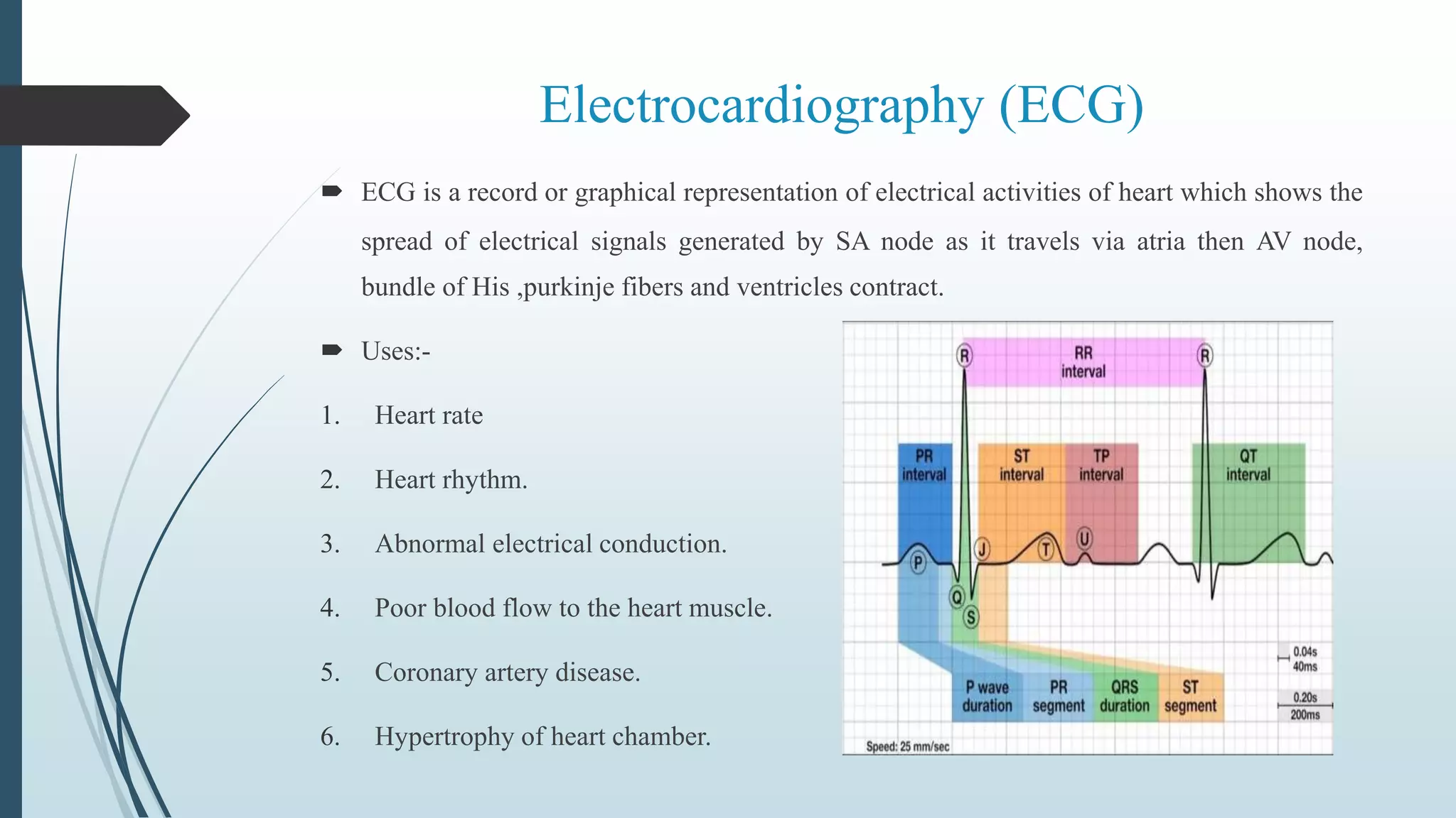 Use of ECG in myocardial infarction | PPTX