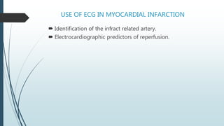 Use of ECG in myocardial infarction | PPTX