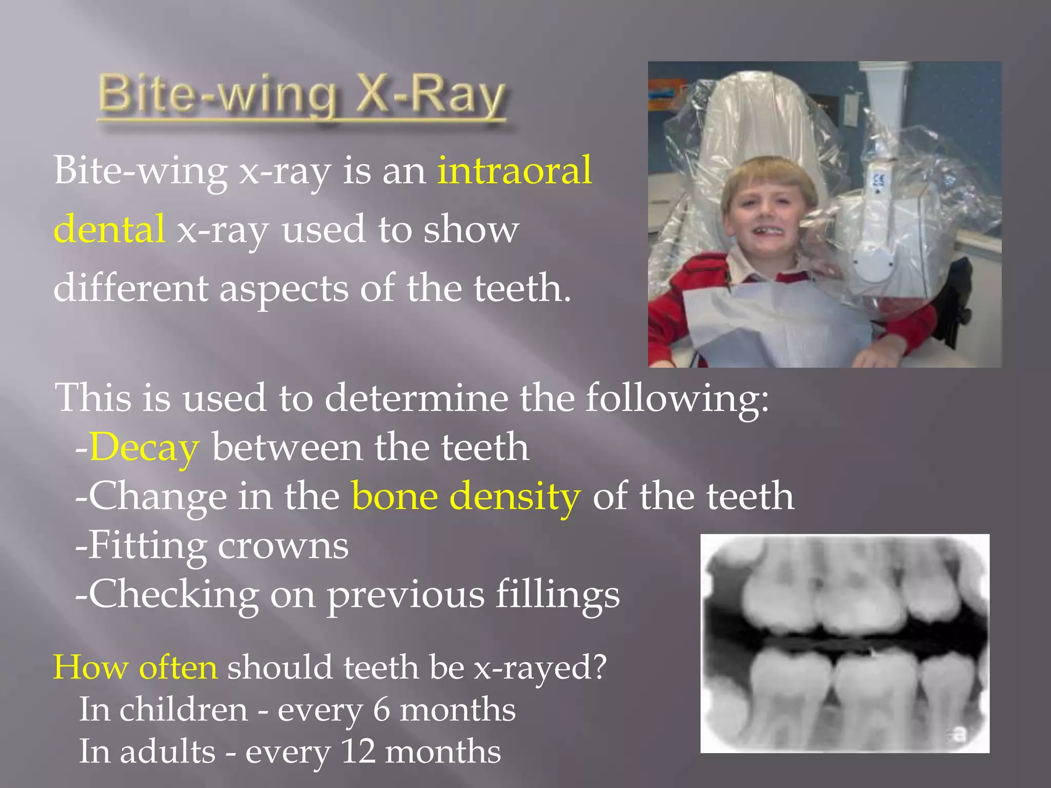 Online Sourceshttp://dictionary.webmd.comhttp://www.webmd.comhttp://www.oncolink.org/resources/article.cfm?c=3&s=38&ss=156&id=349http://www.medicinenet.com/dental_x-rays_when_to_get_them/article.htm
