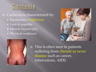 CachexiaCachexia is characterized by: Involuntary weight lossLoss of appetiteMuscle hypotrophyPhysical weaknessThis is often seen in patients suffering from chronic or sever disease such as cancer, tuberculosis, AIDS.The management of cachexiacan be  complicated.  The weight loss can be secondary to side effects from illness and/or treatments. Nutritional therapy and pharmaceuticals  may have some success in improving the patient’s quality of life and life expectancy.