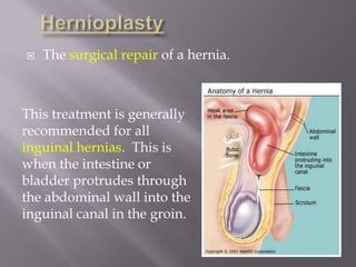 Hernioplasty is usually done as outpatient surgery.  During surgery, the hernia sac is removed and the inguinal canal is closed off with stitches. Synthetic patches or mesh 	can also be used to 	strengthen the abdominal 	wall and prevent the 	hernia from recurring.