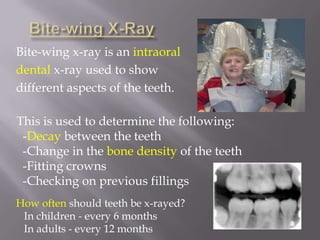 Online Sourceshttp://dictionary.webmd.comhttp://www.webmd.comhttp://www.oncolink.org/resources/article.cfm?c=3&s=38&ss=156&id=349http://www.medicinenet.com/dental_x-rays_when_to_get_them/article.htm