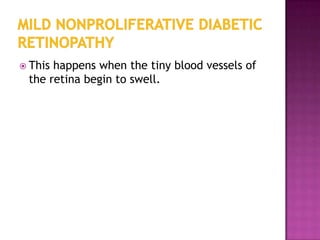  Thishappens when the tiny blood vessels of
 the retina begin to swell.
 