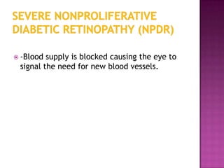  -Blood supply is blocked causing the eye to
 signal the need for new blood vessels.
 