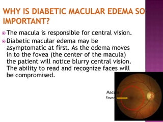  The  macula is responsible for central vision.
 Diabetic macular edema may be
  asymptomatic at first. As the edema moves
  in to the fovea (the center of the macula)
  the patient will notice blurry central vision.
  The ability to read and recognize faces will
  be compromised.

                                      Macula
                                      Fovea
 