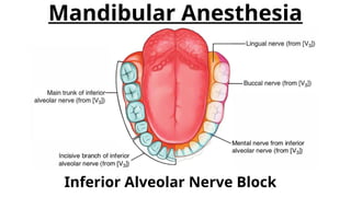 Mandibular Anesthesia and Inferior Alveolar Nerve Block Techniques | PPTX