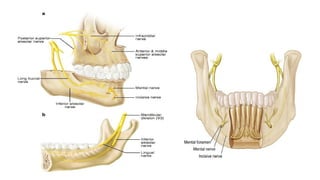Mandibular Anesthesia and Inferior Alveolar Nerve Block Techniques | PPTX