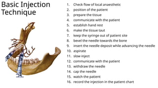 Mandibular Anesthesia and Inferior Alveolar Nerve Block Techniques | PPTX
