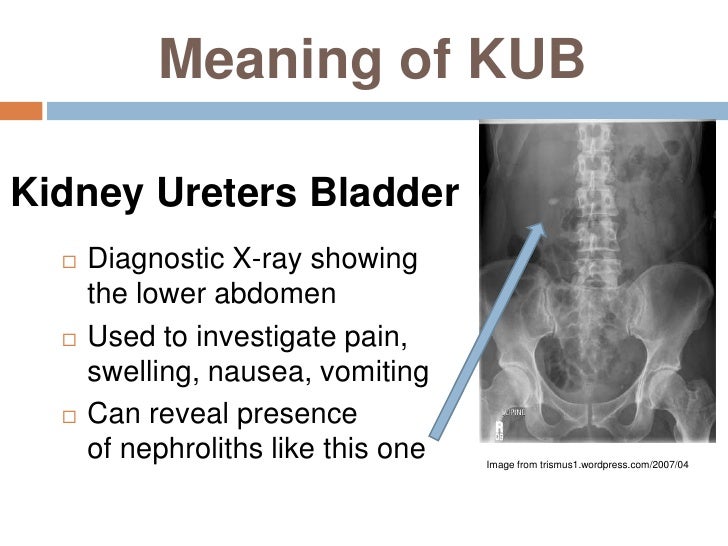 When the Going Gets Tough -- Five abbreviations related to the urinar…