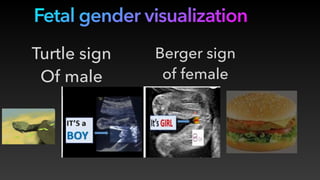 Presentation 9 gender.pdf