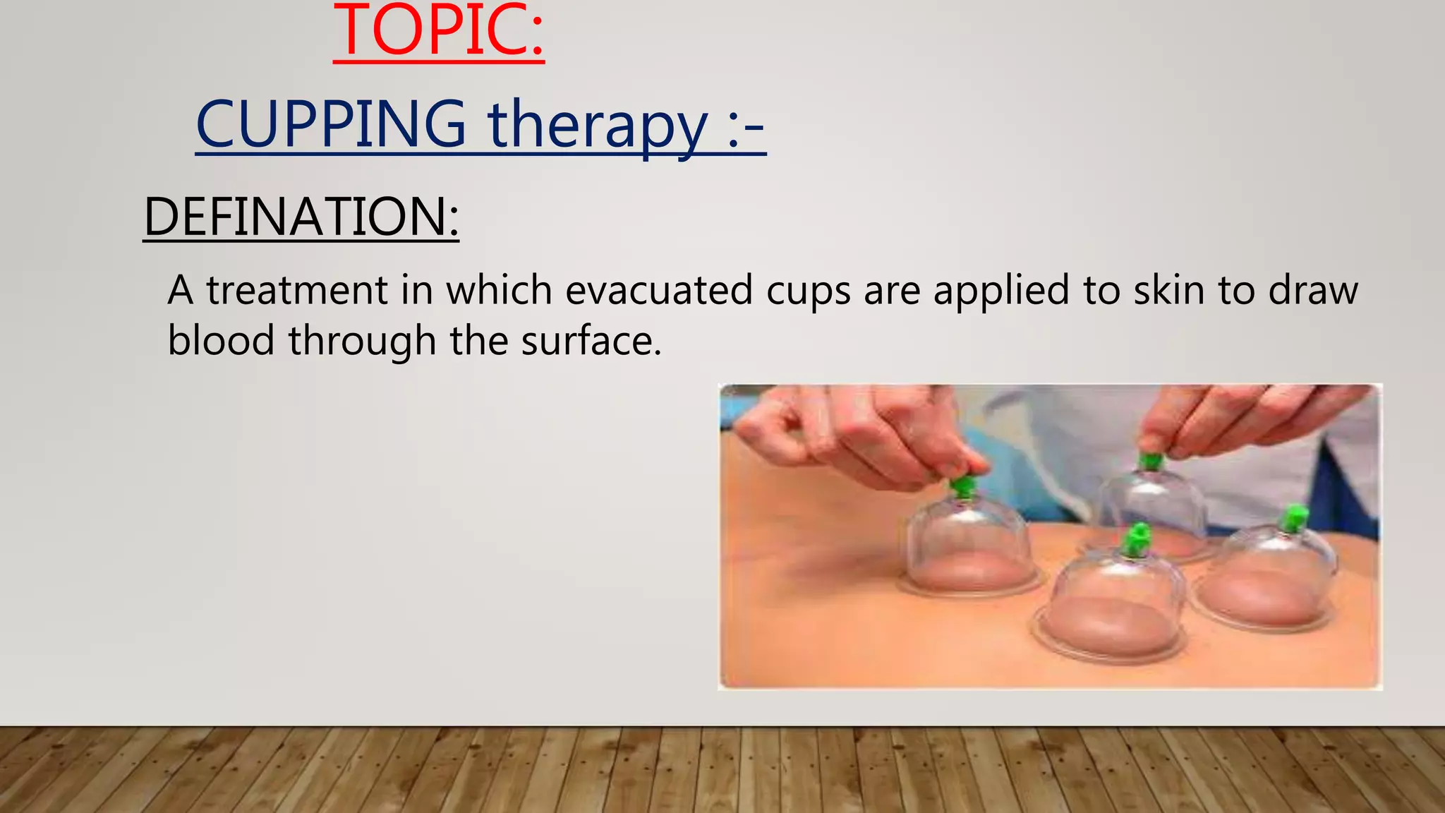 Presentation about cupping | PPTX
