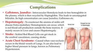 Complications
• Gallstones, Jaundice : Intravascular Hemolysis leads to free hemoglobin in
the plasma, which is then recycled by Haptoglobin. This leads to unconjugated
bilirubin. Its high concentration can cause Jaundice, Gallstones etc.
• Hepatomegaly : To counteract the anemia of sickle cell
disease Extra-medullary Hematopoiesis can occur, which
is red blood cell production outside the bone marrow. It
mainly occurs in Liver and causes Hepatomegaly.
• Stroke : Sickled Red Blood Cells can get stuck in
the cerebral vasculature, causing stroke.
• Acute Chest Syndrome : Caused when vaso-occlusion
occurs in the blood vessels of Lungs. It can also lead to
higher blood pressure in lungs, known as Pulmonary
Hypertension.
 