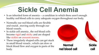 Sickle Cell Anemia
• Is an inherited form of anemia __ a condition in which there aren’t enough
healthy red blood cells to carry adequate oxygen throughout our body.
• Normally our red blood cells are flexible
and round , moving easily through our
blood vessels.
• In sickle cell anemia , the red blood cells
become rigid and sticky and are shaped
like sickles or crescent moons.
• These irregularly shaped cells can get stuck
in small blood vessels , which can slow or
block blood flow and oxygen to parts of the
body.
 